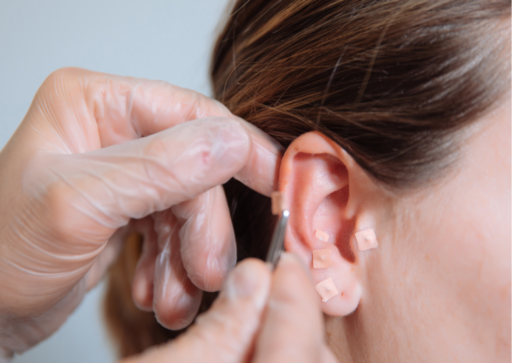 目黒区の耳つぼダイエットの施術風景